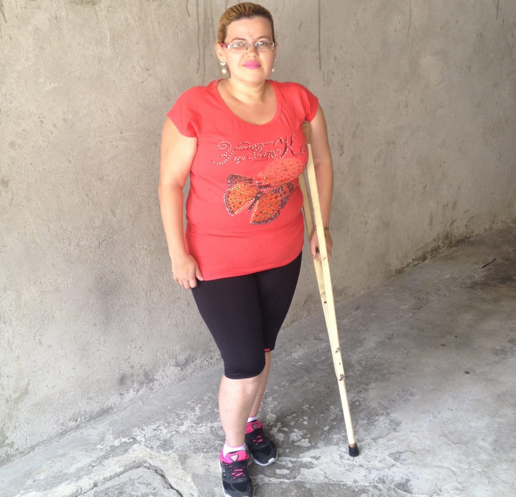 A auxiliar Jaqueline da Silva, 32, se recupera após quebrar a perna depois de escorregar numa passagem improvisada.
